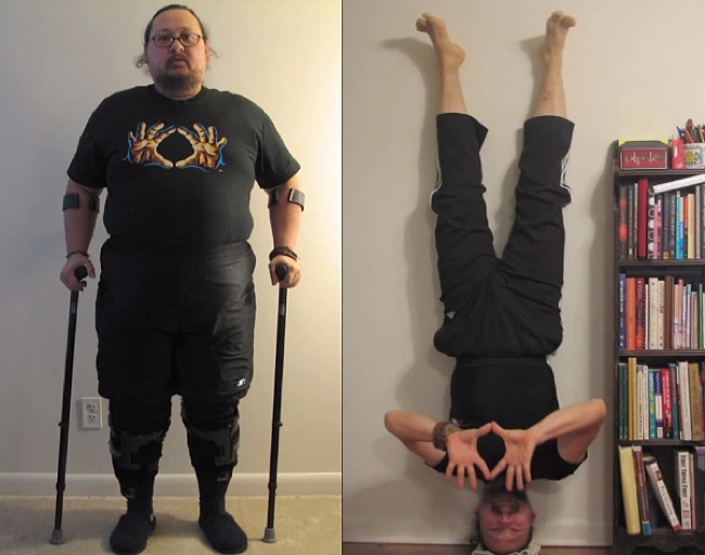 Injured Veteran Was Told He Would Never Walk Again. What Really Happened Is Utterly Inspiring.