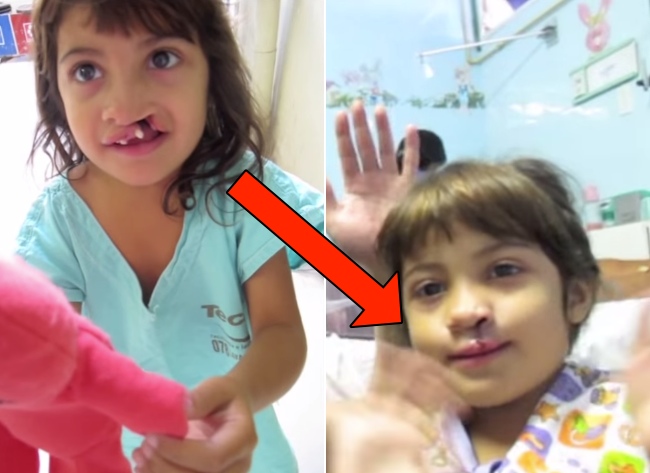 Little Girl Sees Her New Smile For The First Time After Surgery. Her Reaction Is Heart-Warming.
