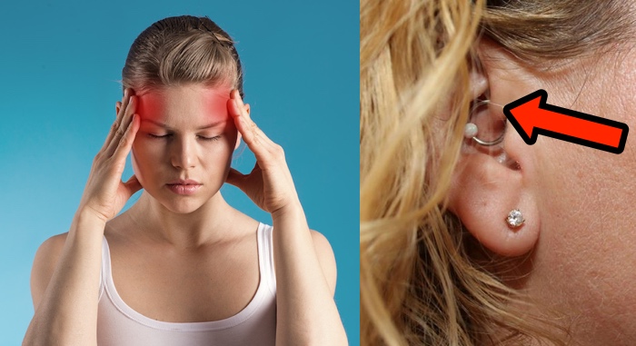 How A Simple Ear Piercing Could Cure Your Migraines