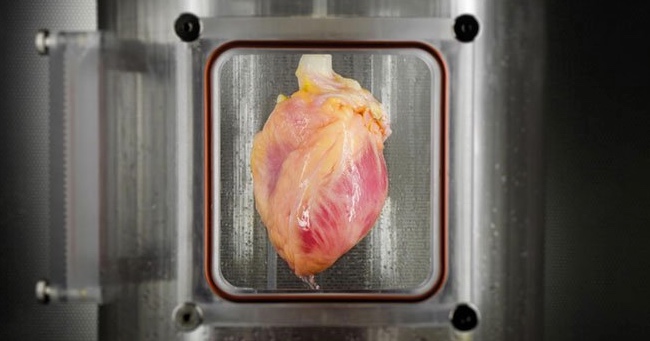 Beating Human Heart Grown With Stem Cells Developed In A Laboratory