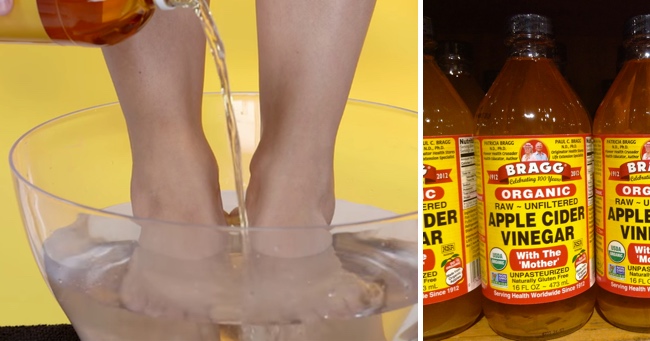 16 Beauty and Health Uses For Apple Cider Vinegar