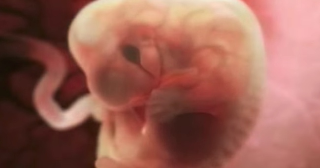 Video Shows 9 Months of Pregnancy in Just 4 Minutes