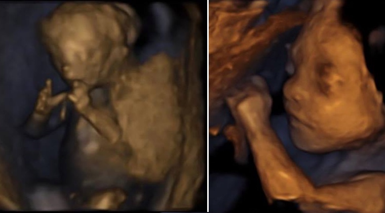 Doctors See Something Strange In Ultrasound, Then Mom Says Baby Isn’t Hers