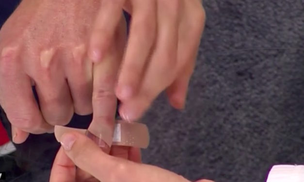 Doctors Teach Simple Life Hack to Keep Band-Aids from Falling Off of Your Skin