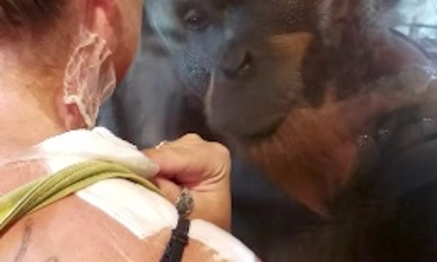 Kind Orangutan Meets Burn Victim, Has Heartwarming Reaction That Caught Internet by Surprise