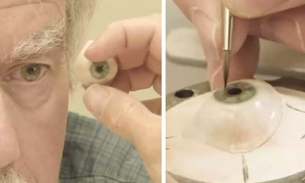 Artistic Talent and Prosthetic Technology Meet to Recreate Man’s Lost Eye